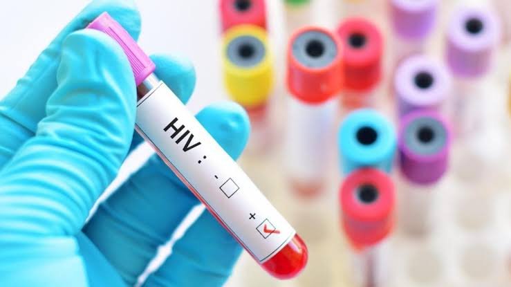 Kenya sex workers face HIV crisis after US aid disruption